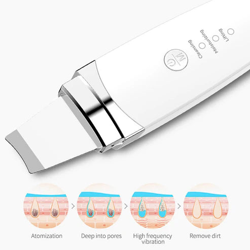 Ultrasonic Facial Cleanser – Electromechanical Beauty Instrument for Deep Skin Peeling & Pore Cleaning
